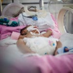 A tiny newborn baby laying in an incubator laying on a pink blanket with several tubes attatched to her.