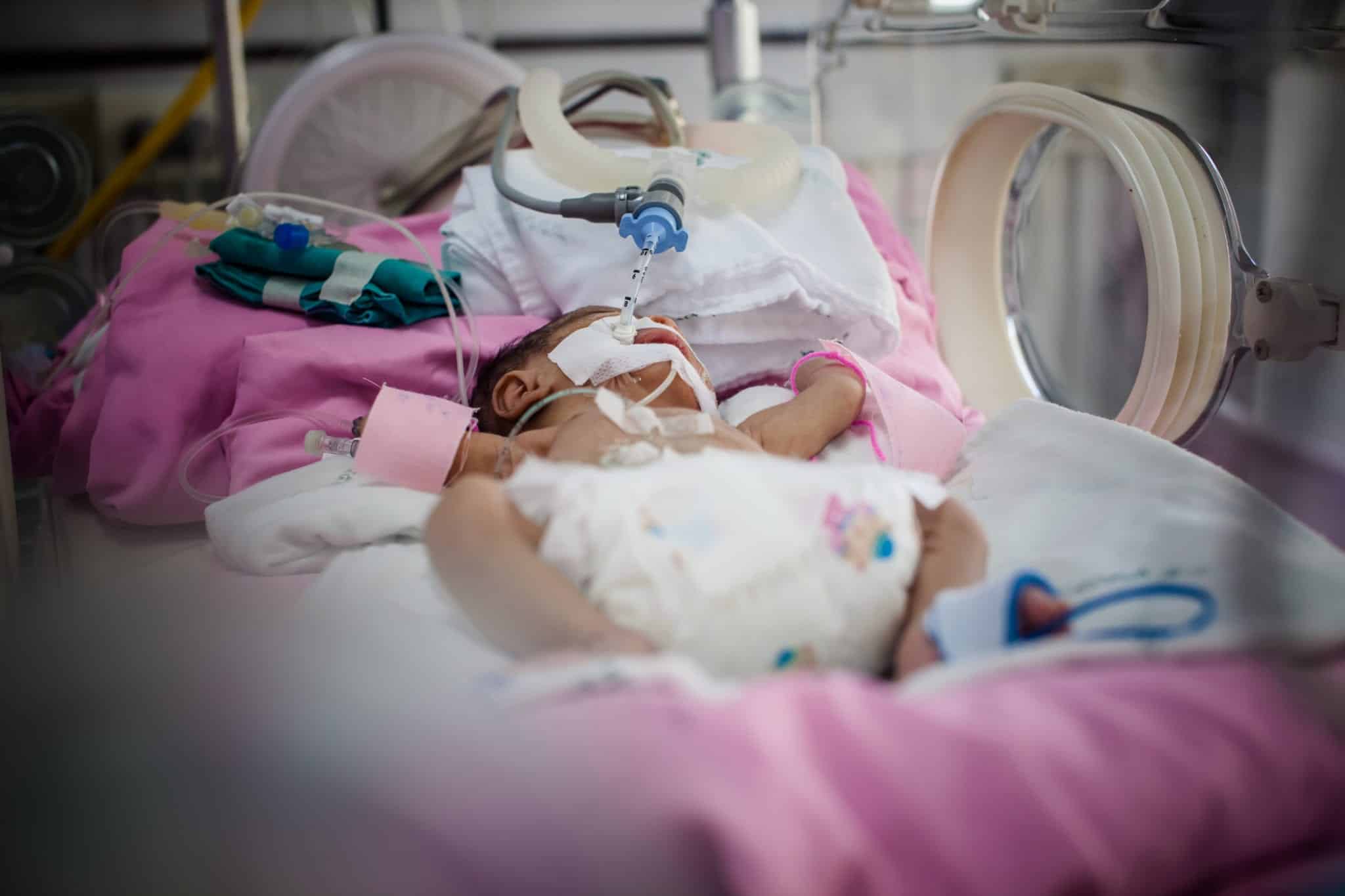 A tiny newborn baby laying in an incubator laying on a pink blanket with several tubes attatched to her.