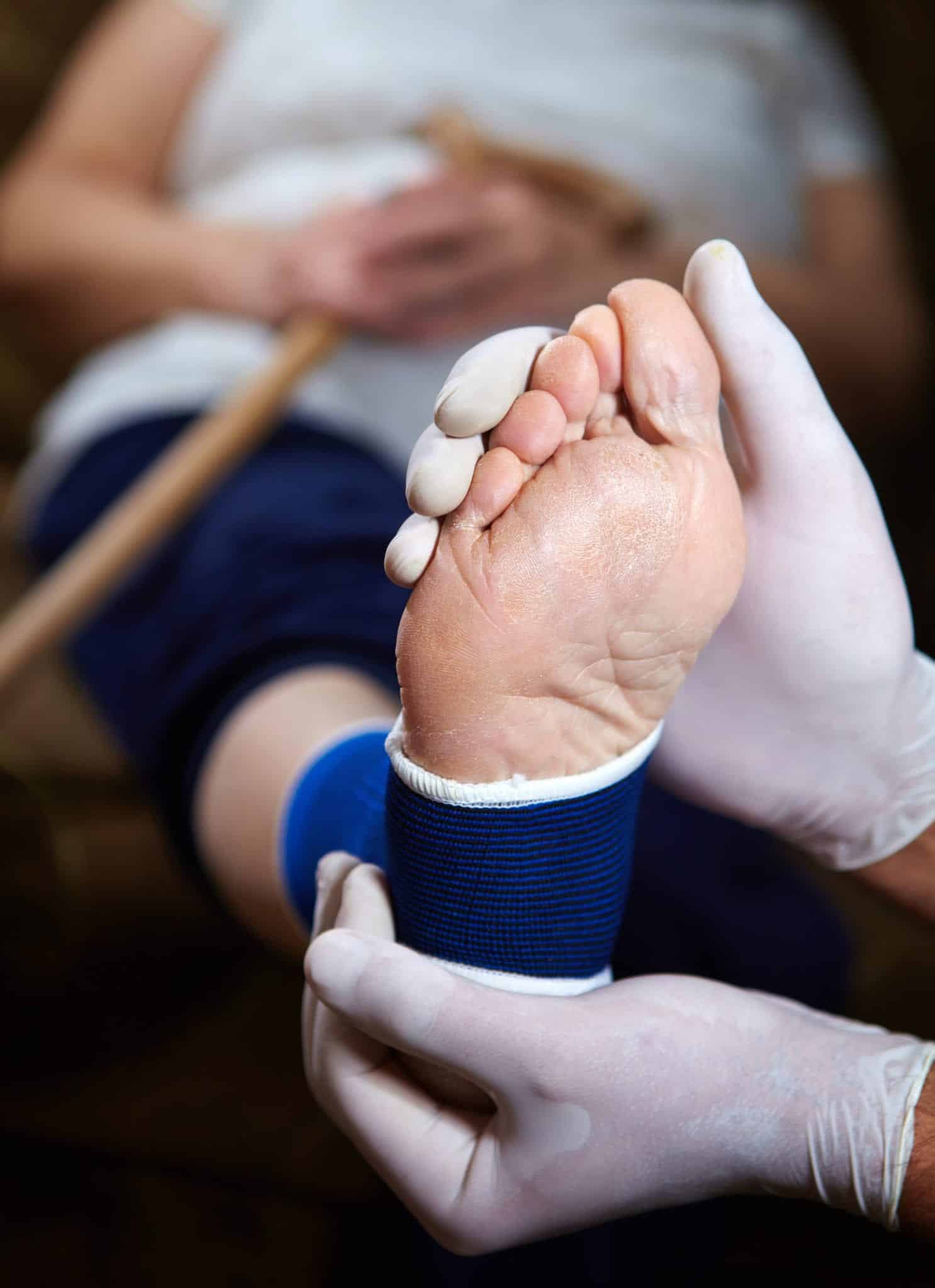 A blurry view of a woman in the background holding a wooden cane with a close-up view of her foot, wearing a blue ankle brace and beling held by a doctors white gloved hands inthe foreground.