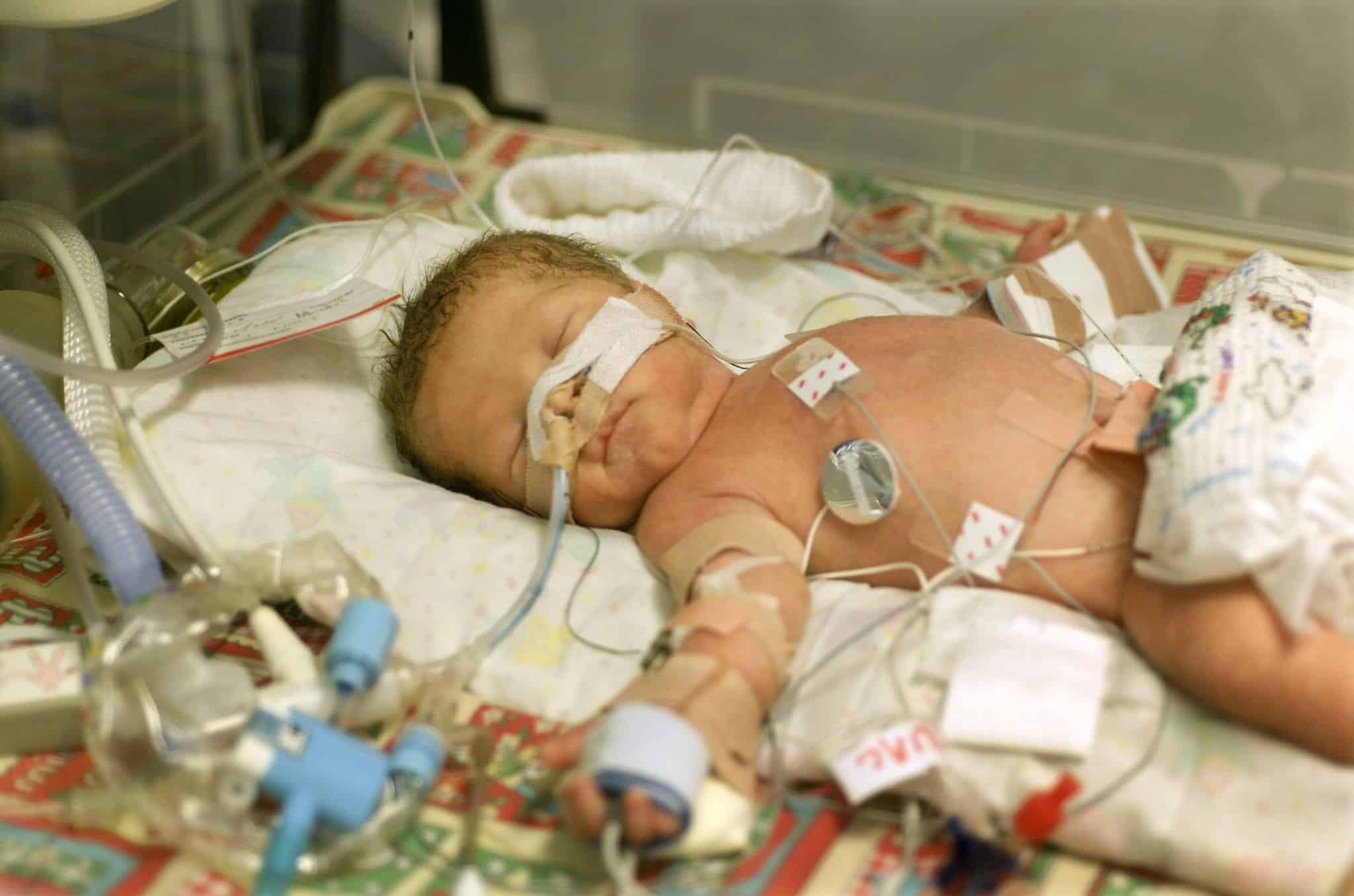 An infant laying in a hospital incubator connected to several wires and tubes.