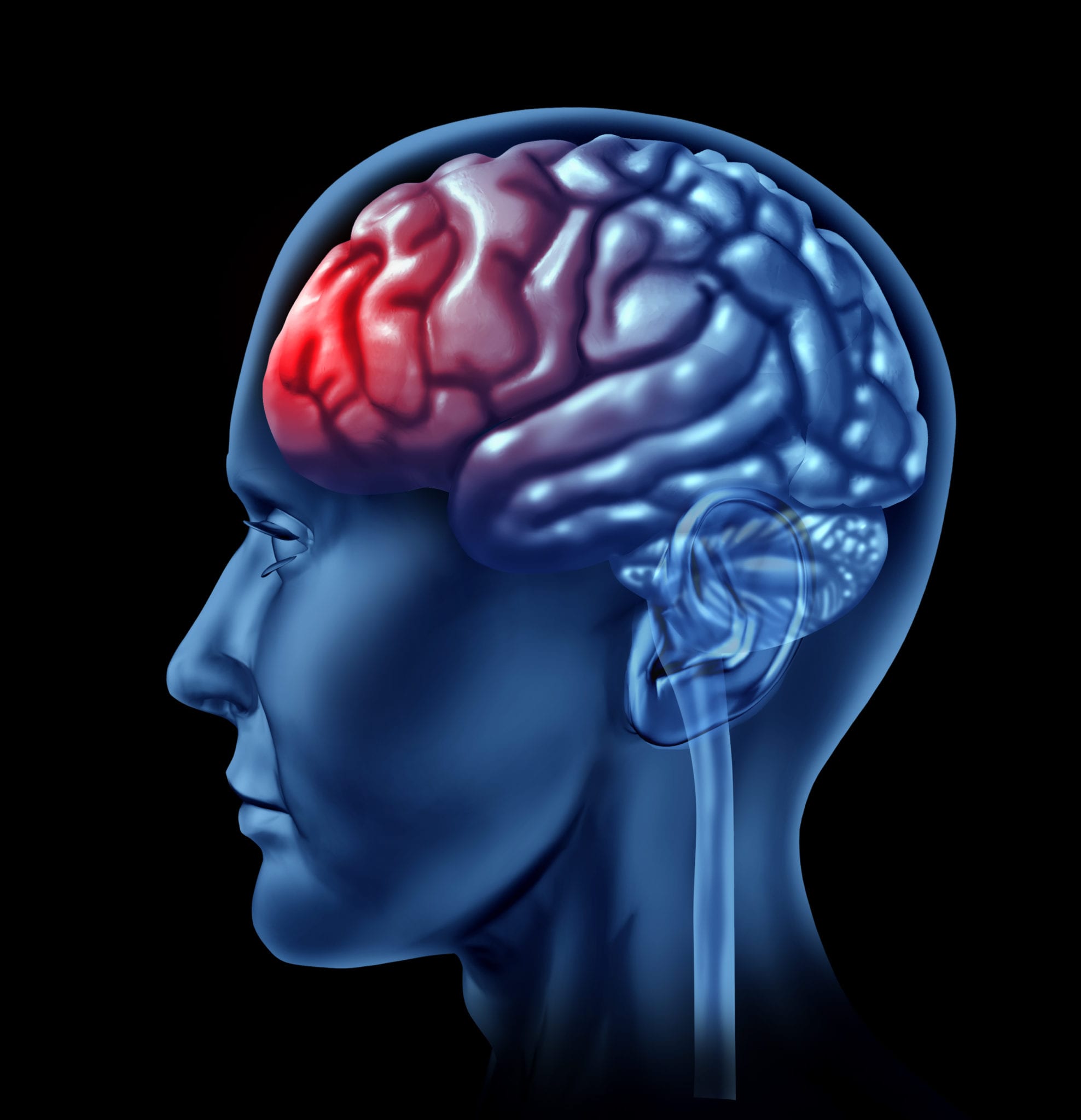 A 3D rendering of a blue transparent human head from the side showing the brain and spinal cord in blue but the front lobe of the of the brain is a bright red.