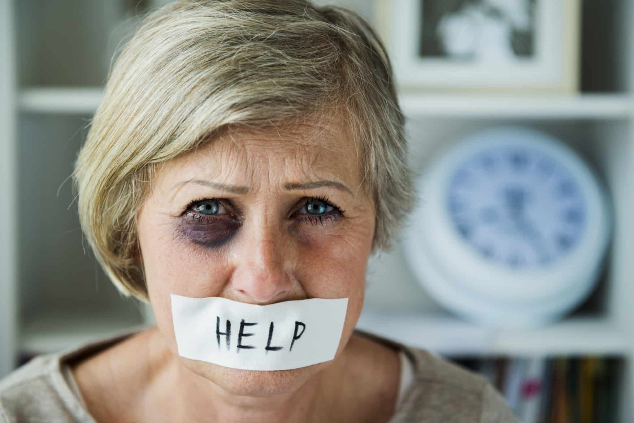 An elderly woman with a black eye and white tape covering her mouth with the word help written on the tape.