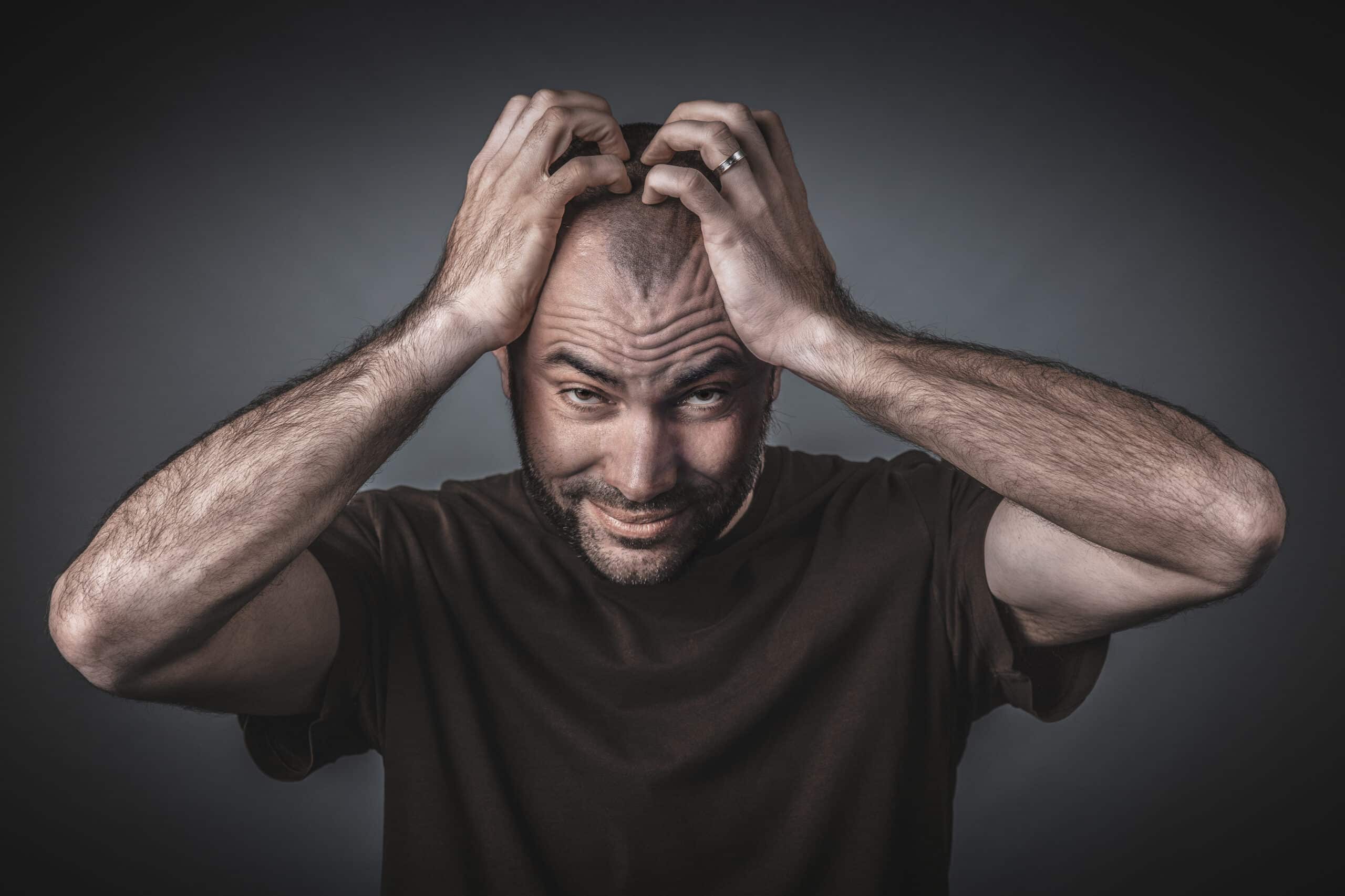 Man with both hands on head, looking straight at the camera.