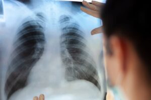 The doctor examines the x-ray